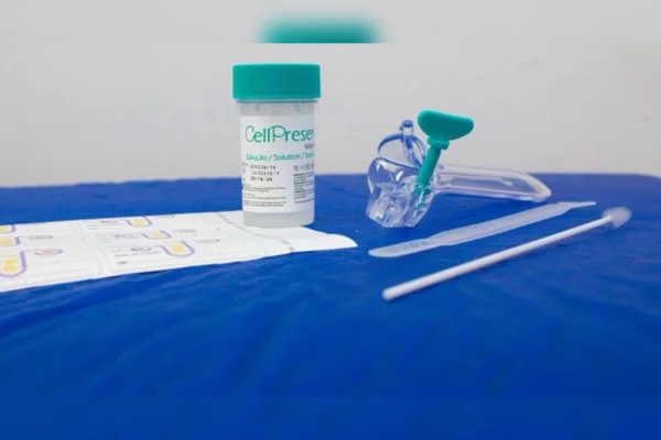 Imagem do teste de biologia molecular DNA-HPV. Metrópoles