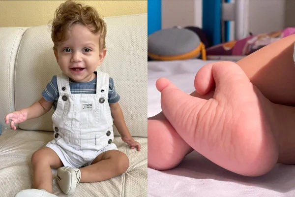 Matteo Barboza tem os pés em formato de coração por malformação congênita - Metrópoles