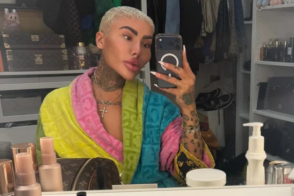 Quem era Jordan James Parke, o “Rei dos Lábios” de Botched