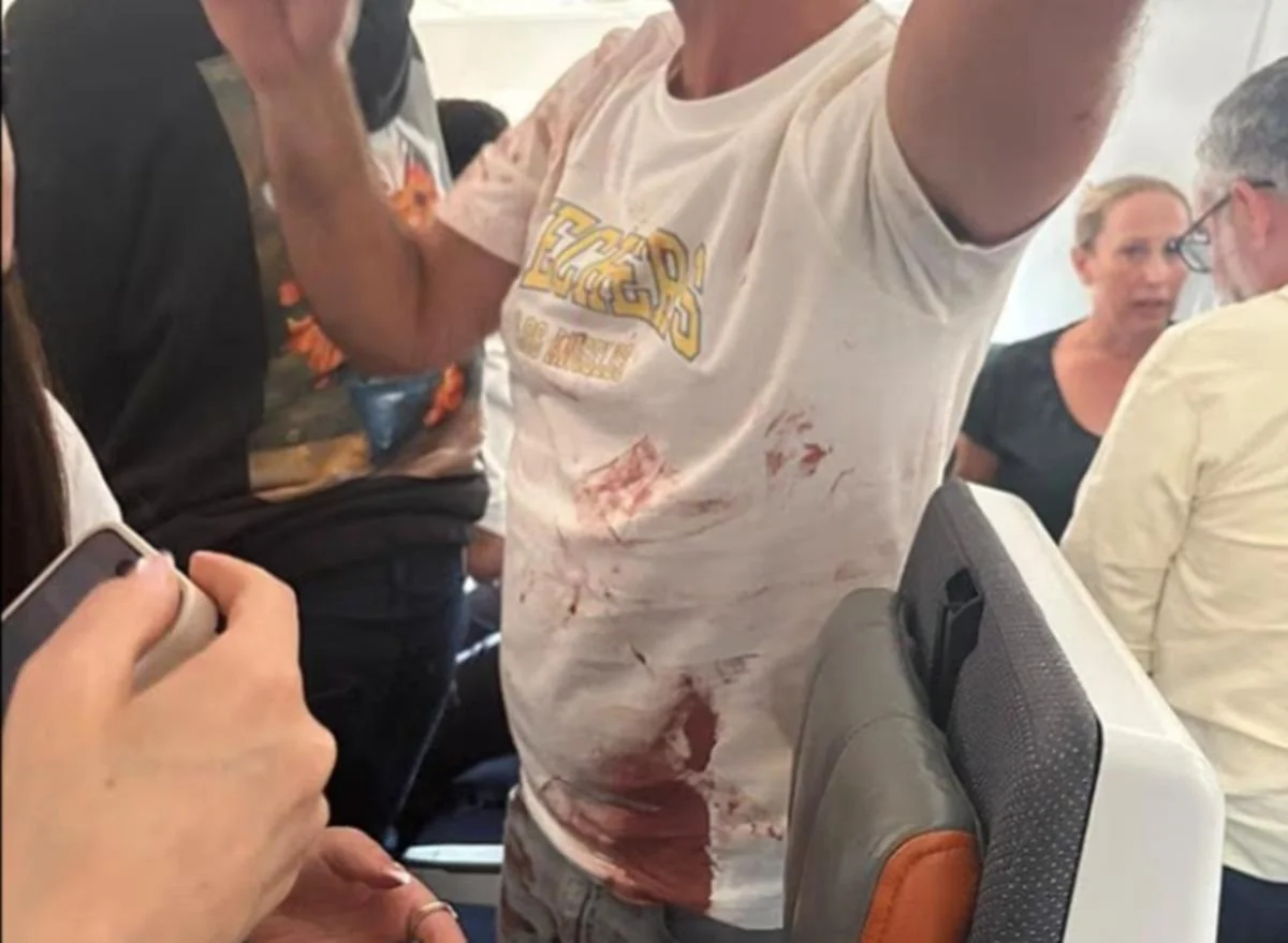 Passageiro com a camisa ensanguentada Passageiro com a camisa ensanguentada