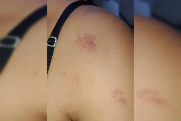 Marido é preso após agredir e deixar mulher com marcas roxas no corpo