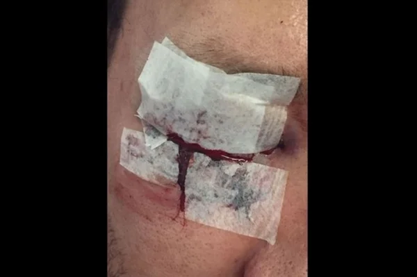 Polícia Civil investiga agressão a jovem após festa no Lago Sul