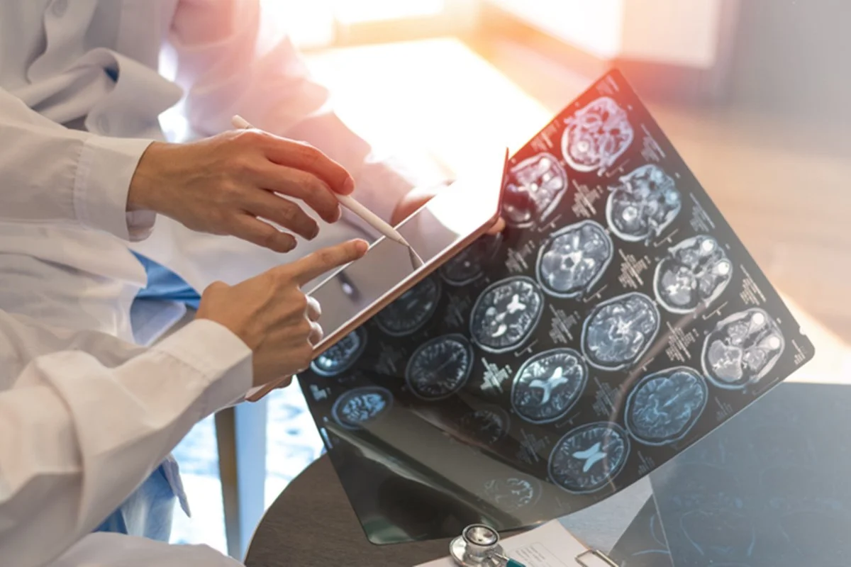 SUS incorpora medicamento para ELA: política pública ou tardança?