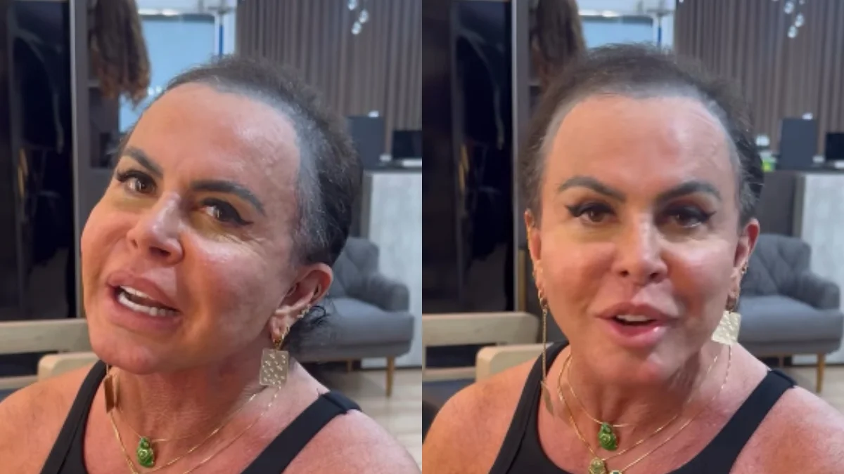 Gretchen aparece sem prótese capilar e revela destino de cabelo