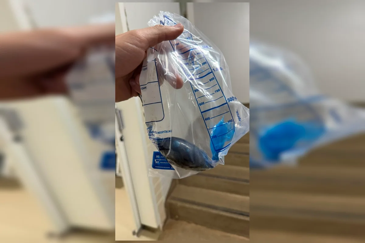 Mulher é flagrada tentando entrar na Papuda com cocaína no ânus - imagem 2 Mulher é flagrada tentando entrar na Papuda com cocaína no ânus - imagem 2