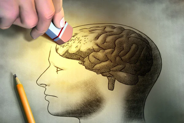 Desenho colorido de cérebro sendo apagado por uma borracha - Metrópoles - ilustração sobre o Alzheimer