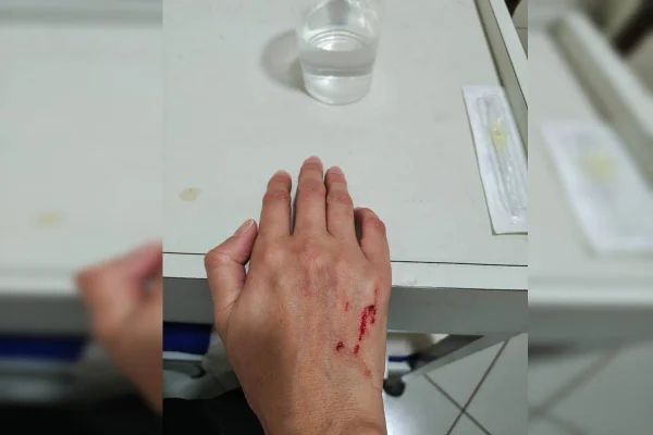 Enfermeira é agredida dentro de hospital público do DF - destaque galeria Enfermeira é agredida dentro de hospital público do DF - destaque galeria