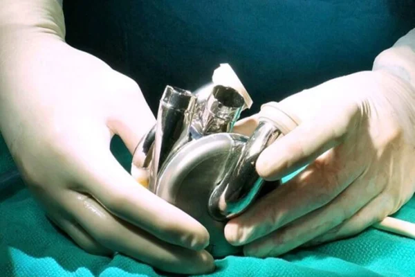 Imagem de médico segurando coração artificial de titânio - Metrópoles
