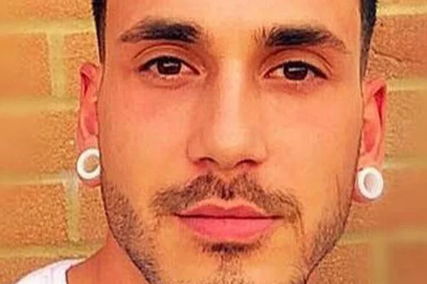 Mulher morde e arranca bochecha de homem que a chamou de “gostosa”