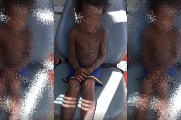 Criança morre e três ficam feridas após maus-tratos dos tios