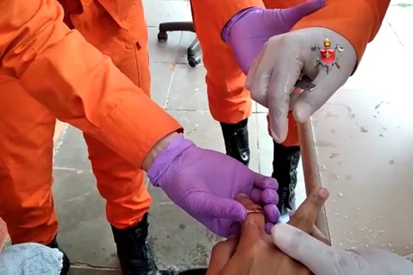 Bombeiros socorrem adolescente que ficou com dedo preso em anel