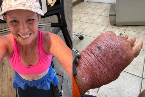 Foto da personagem Melinda Howard. A foto é uma selfie dela na academia e ao lado a mão infeccionada. Metrópoles
