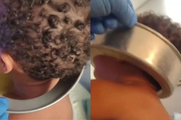 Um bebê de 1 ano colocou uma forma de bolo na cabeça e ficou preso. Ele foi resgatado pelos bombeiros de São Vicente, no litoral paulista - Metrópoles