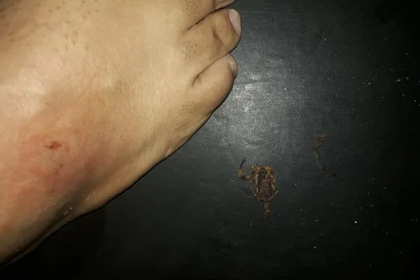 Homem é picado por escorpião enquanto assistia a filme em cinema do DF