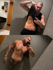 Diego Menasse apresentou complicações após passar por uma cirurgia