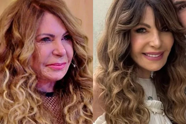 Elba Ramalho em 2023 e em 2025 com procedimentos