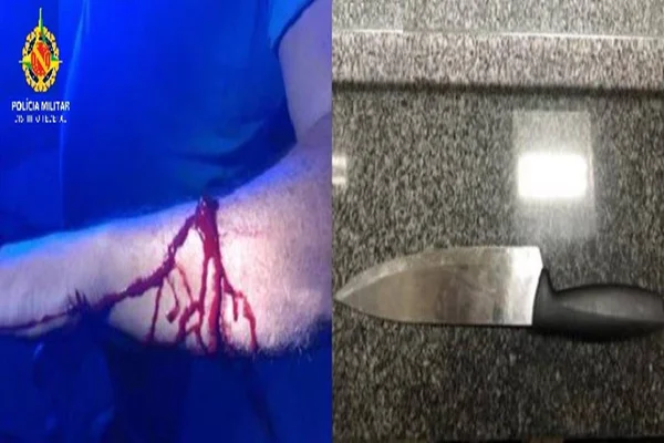 Braço com sangue e faca