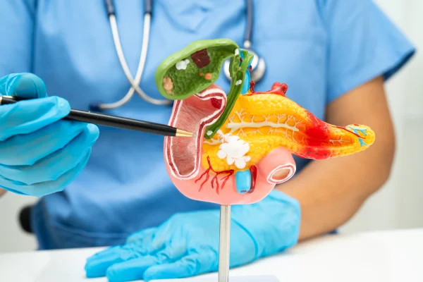 Foto colorida de médico com luvas apontando em direção a um pâncreas humano de mentira - Gastroenterologistas explicam os principais sintomas de pancreatite - Metrópoles