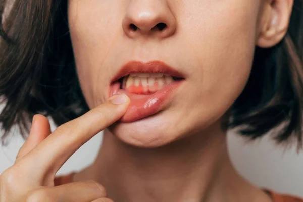 Foto de mulher com dedo no lábio inferior - Metrópoles