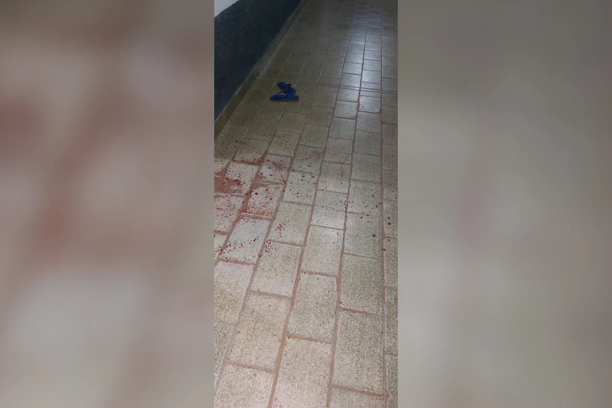 Suspeito de agredir mulher decepa mão de PM e é baleado em MT - imagem 2 Suspeito de agredir mulher decepa mão de PM e é baleado em MT - imagem 2