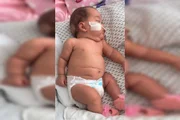 Mesmo com pouco tempo de vida, ela já passou por cinco cirurgias Mesmo com pouco tempo de vida, ela já passou por cinco cirurgias