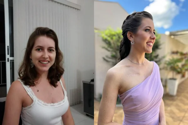 10 anos após vencer melanoma, paciente ainda vive com medo da doença