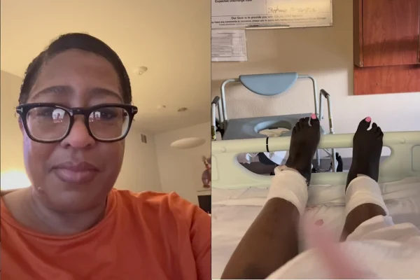 Imagem colorida de Denise com os pés necrosados - Metrópoles