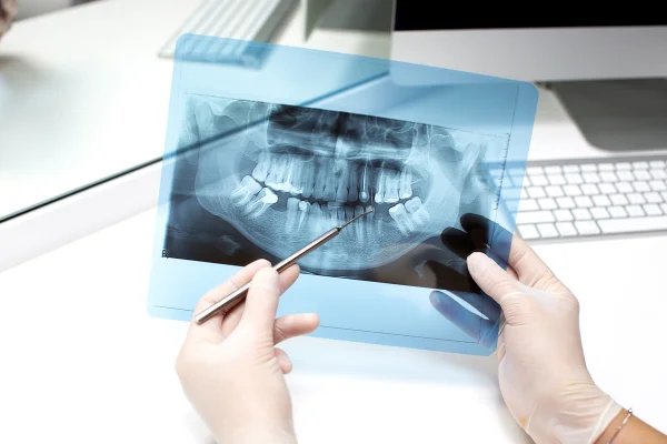 Dentista analisa radiografia. Metrópoles