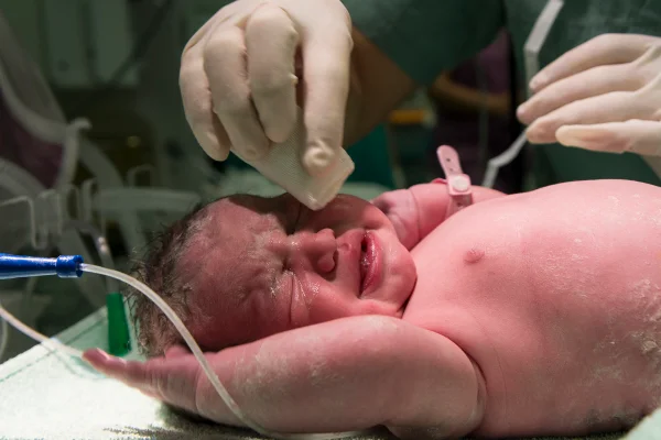 Foto colorida de bebe em UTI neonatal - Metrópoles.