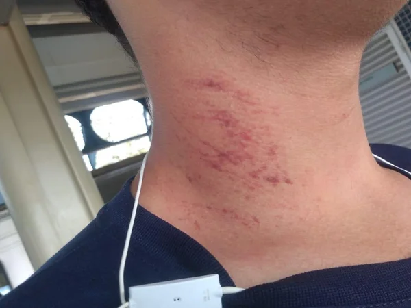 DF: adolescente denuncia agressão por seguranças em estação do metrô