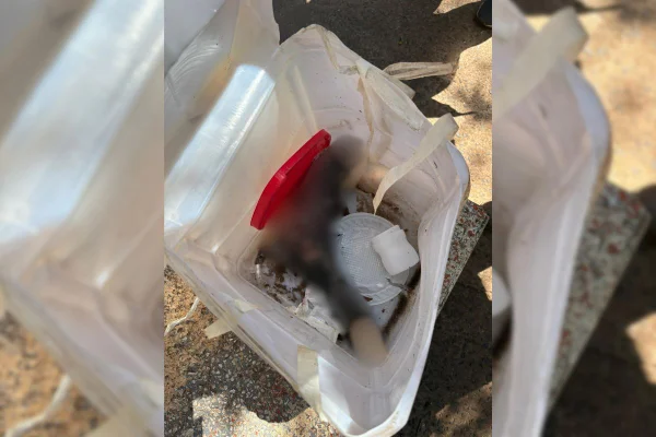 Investigações apontam que pé humano pertencia a paciente que foi submetido a amputação em janeiro de 24. Caso é de Assis, no interior de SP - Metrópoles