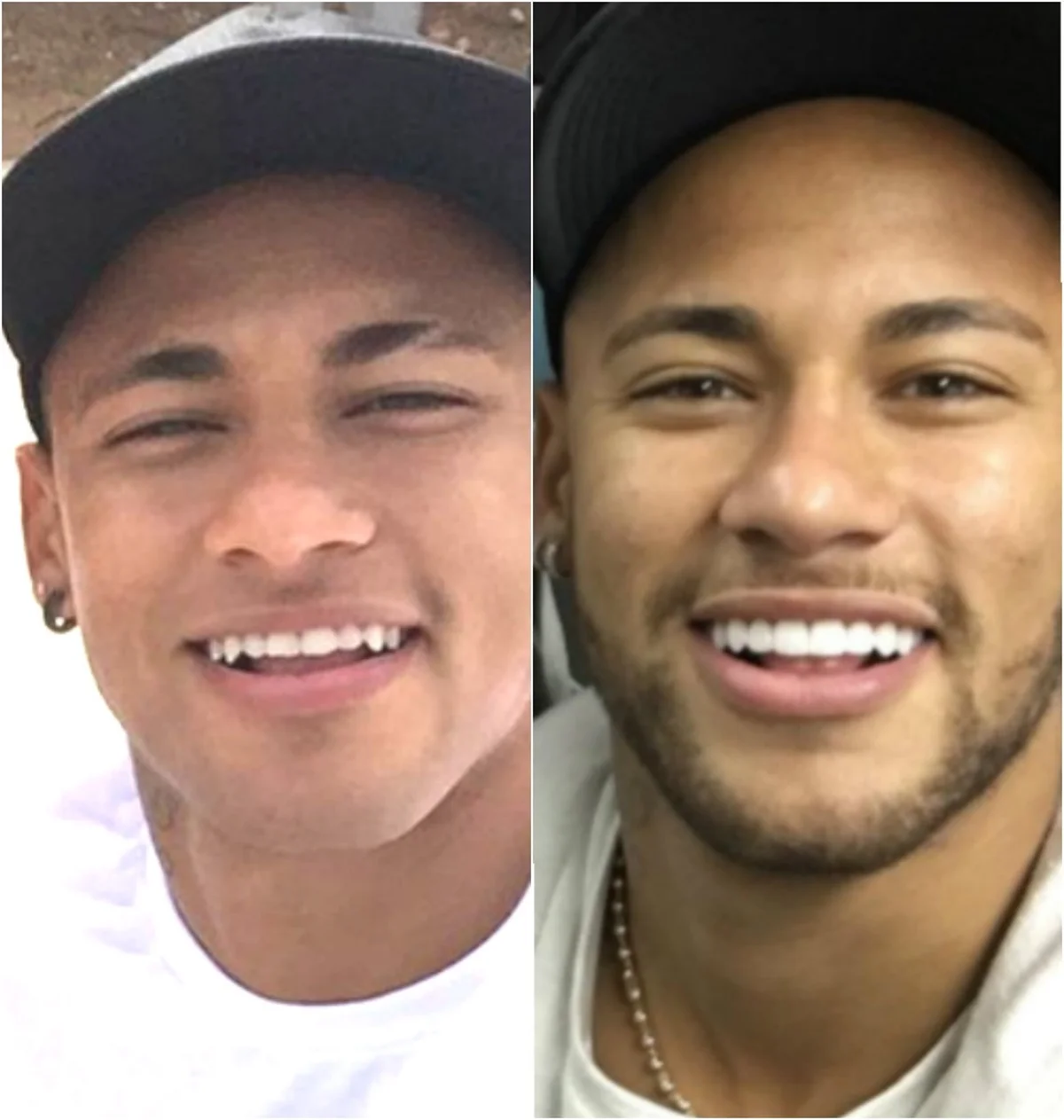 Neymar também entrou na tendência do sorriso natural Neymar também entrou na tendência do sorriso natural
