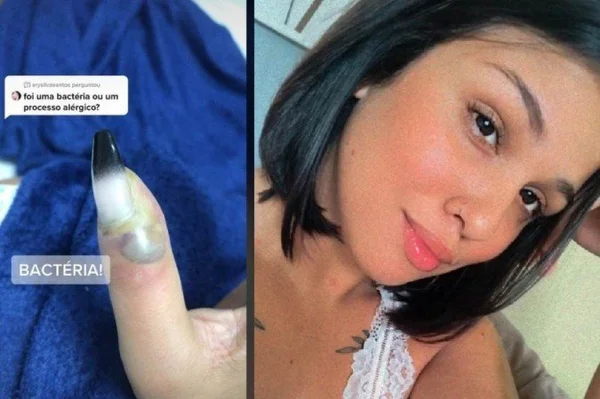 Fazer alongamento de unha é perigoso? Entendo os riscos