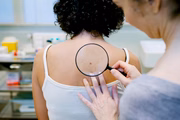 Os casos de não-melanoma são mais frequentes e apresentam altos percentuais de cura. Além disso, esse é o tipo mais comum em pessoas com mais de 40 anos e de pele clara