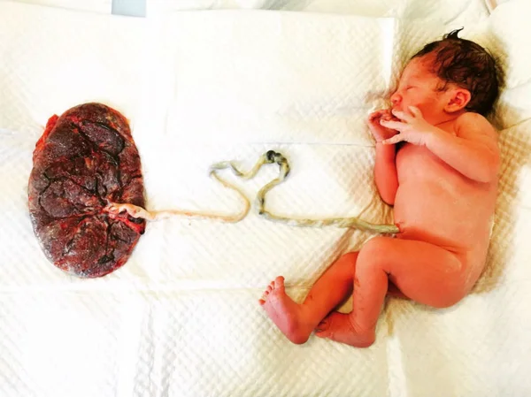 Eu também “comi” a minha placenta. E faria de novo