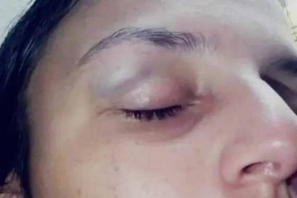 Homem bate na ex após pedir para eles reatarem e fazerem sexo
