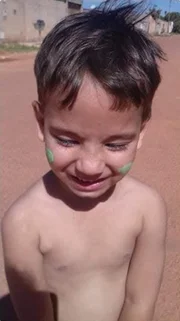 A criança retornou à UPA outras duas vezes, pois os sintomas persitiam