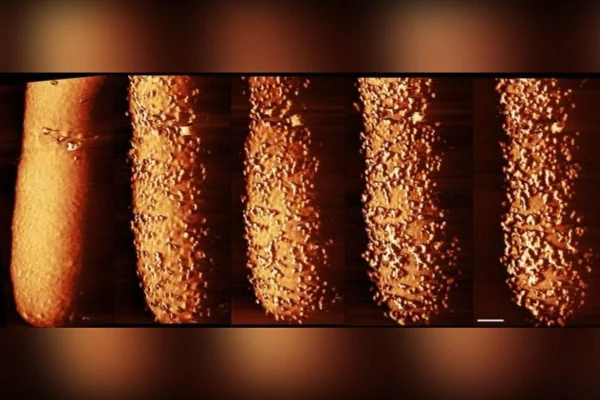 Imagem composta de E. coli exposta ao antibiótico polimixina – as imagens mostram as alterações na camada externa da couraça ao longo do tempo. Da esquerda para a direita: bactéria não tratada com o antibiótico; bactéria após 15 minutos; após 30 minutos; após 60 minutos; após 90 minutos. A barra de escala branca tem 250 nanômetros de diâmetro. Metrópoles