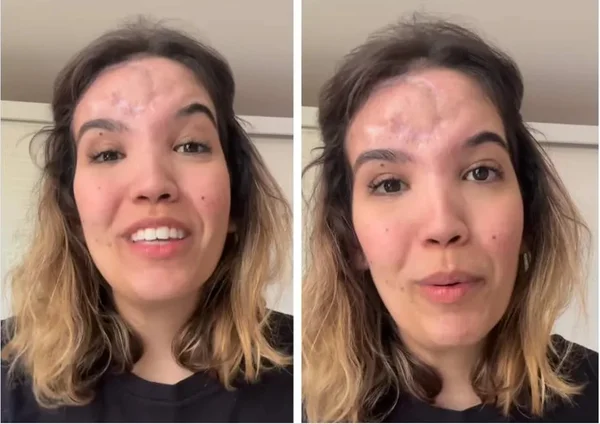 mulher com ferimento na cabeça