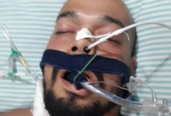 Traficante é preso ao se ferir com fuzil e alegar acidente de trabalho