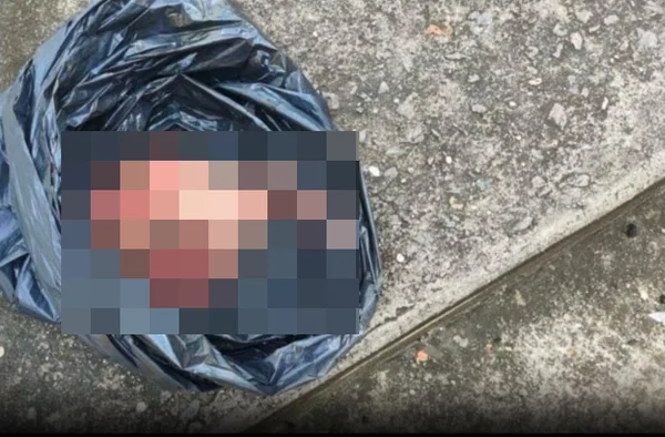 Polícia investiga feto enrolado em saco plástico e deixado em lixeira