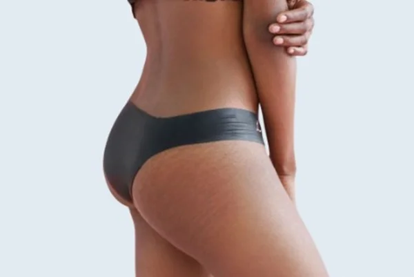 foto de modelo usando calcinha lorals