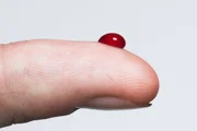 A pré-diabetes é uma condição que antecede a doença metabólica crônica A pré-diabetes é uma condição que antecede a doença metabólica crônica