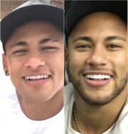 Neymar também entrou na tendência do sorriso natural Neymar também entrou na tendência do sorriso natural