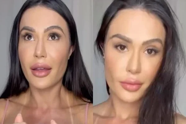 "Reaprendendo a andar", diz Gracyanne Barbosa sobre cirurgia no joelho - Metrópoles