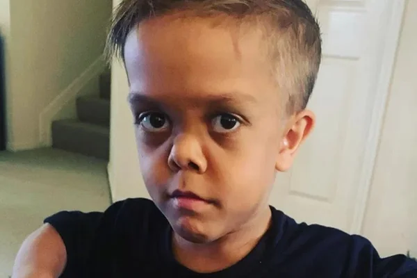 Menino que sofreu bullying é acusado de ser adulto e mãe desabafa