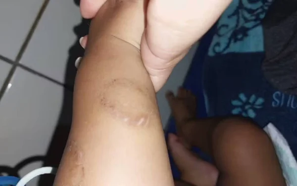 imagem colorida bebe vitima tortura goias