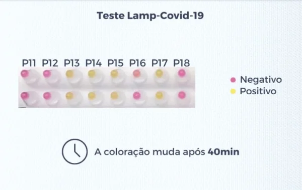 Teste Covid UFRJ