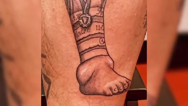 Torcedor da Argentina tatua tornozelo inchado de Messi