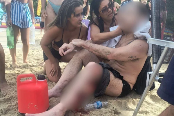 Imagem colorida mostra banhista ferido após ser atingido por embarcação no litoral de SP. Metrópoles